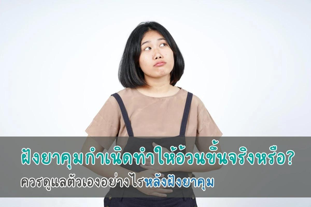 ฝังยาคุมกำเนิดทำให้อ้วนขึ้นจริงหรือ? ควรดูแลตัวเองอย่างไรหลังฝังยาคุม