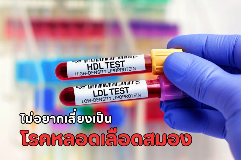 โรคหลอดเลือดสมอง